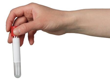 Female hand holding a vacutainer for sampling blood isolated on white background.の写真素材