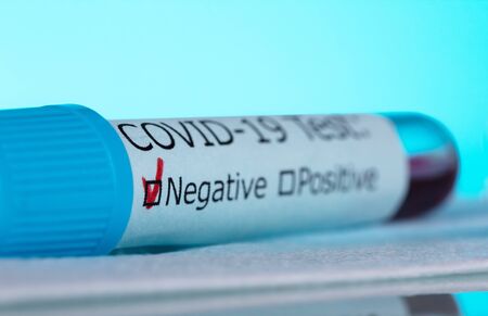 Macro photo of a test tube with a blood sample. Negative test for covid-19, on a blue background.の写真素材