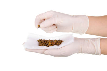 Gallbladder stones in the hands of a doctor after cholecystectomy isolated on white backgroundの写真素材