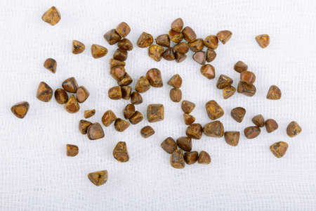 Top view. Gallbladder stones after cholecystectomy with gauze bandageの写真素材