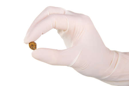 Cholelithiasis (gallbladder stone) after successful operation in the hands of a surgeon isolated on white backgroundの写真素材
