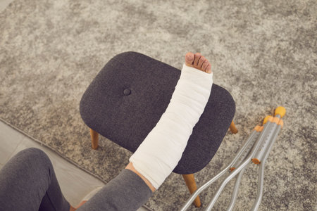 Woman with bone fracture undergoing rehabilitation at home. High angle of broken leg in plaster cast resting on ottoman with crutches beside. Concept of treatment and recovery after physical injuryの写真素材