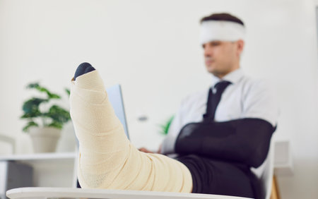 Close up shot of foot of a handicapped business man with broken leg and arm in bandage working from home during rehabilitation. Disabled guy with plastered leg and immobilizer on injured arm.の写真素材