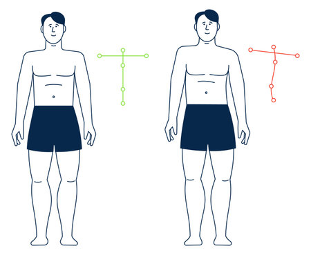 Man spine position. Good and bad posture. Standing personのイラスト素材