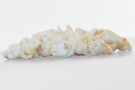  Real Human Wisdom teethの写真素材