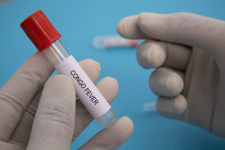 Concept of Laboratory test tube of Crimean Congo hemorrhagic fever or CCHF in handsの写真素材