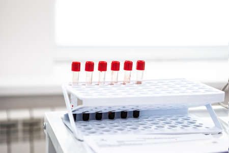 test tubes with blood on the counter in the bright office