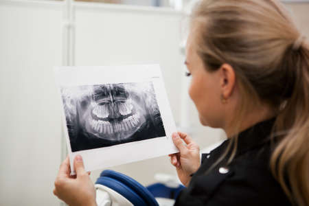 dentist woman with long blond hair in black uniform holds an x-ray of the jaw in her handsの写真素材