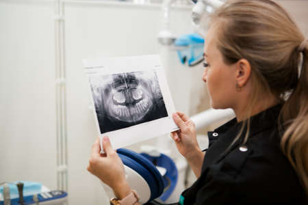 dentist woman with long blond hair in black uniform holds an x-ray of the jaw in her handsの写真素材