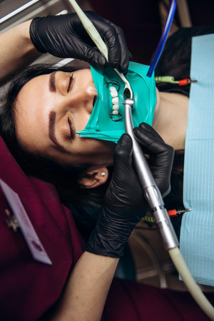 Young woman having dental exam. Close up tooth.の写真素材