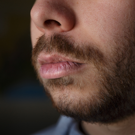 Detail of damaged lips of a young man with beardの写真素材
