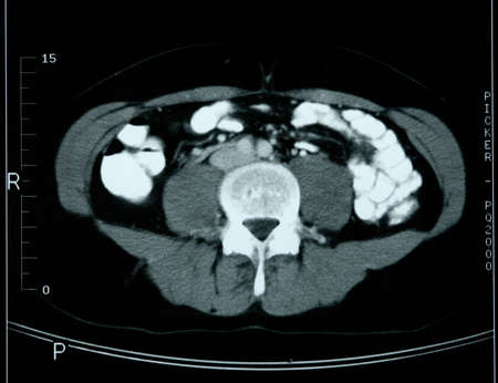 X-rayの写真素材