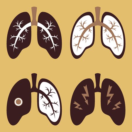 Vector image of the respiratory tract. Icons that can be used as a web design template. COVID-19 virus. Prevention of coronavirus.のイラスト素材