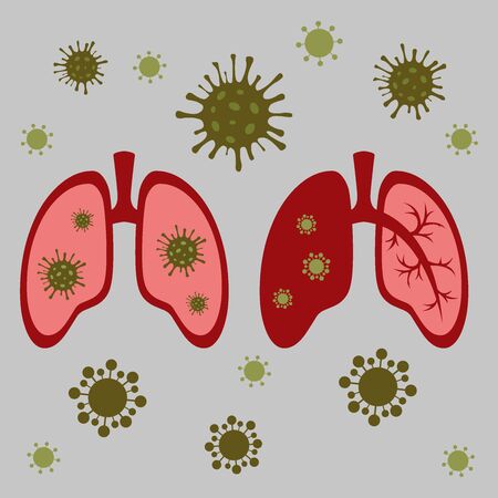 COVID-19 virus. Prevention of coronavirus. An icon that can be used as a web design template. Vector image of the respiratory tract.のイラスト素材