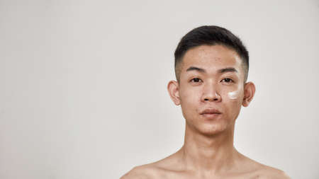 Close up portrait of young asian man with problematic skin applied cream on his face, looking at camera isolated over white background. Beauty, skincare, treatment conceptの写真素材