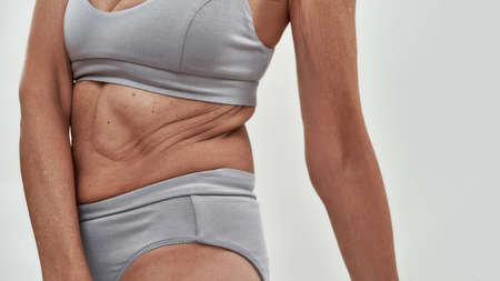 Middle aged woman demonstrating folded skin on waistline