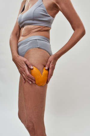 Woman with belly fat rolls applying orange peel to hipの写真素材