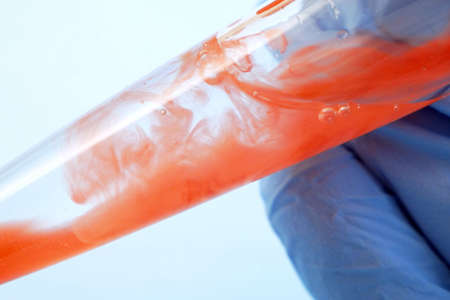 test tubes with blood sample in laboratory, closeup