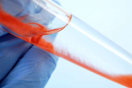 test tubes with blood sample in laboratory, closeup