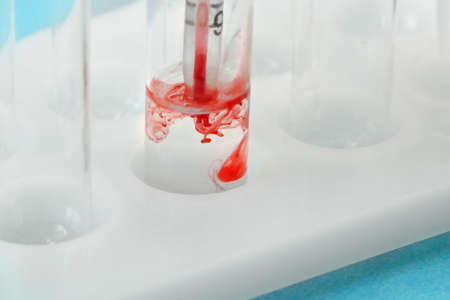 test tubes with blood sample in laboratory, coronavirus testingの写真素材