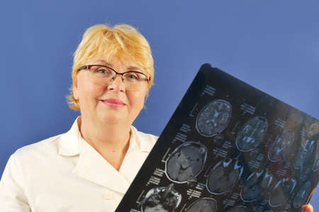 woman doctor looking at x-ray film in hand in coronavirus epidemic time
