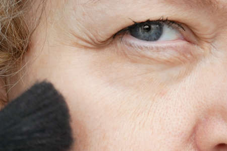 middle-aged woman does makeup, woman with drooping eyelid. Ptosis is a drooping of the upper eyelid,...