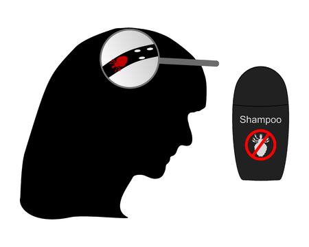 Head of woman, louse, nit and lice shampooのイラスト素材