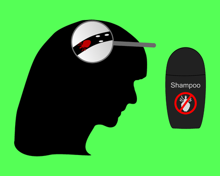 Head of woman, louse, nit and lice shampooのイラスト素材
