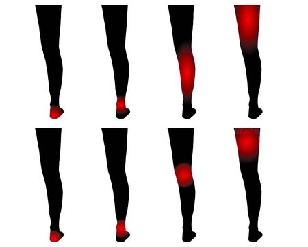 Human legs with pain pointsのイラスト素材