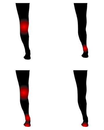 Human legs with pain pointsのイラスト素材