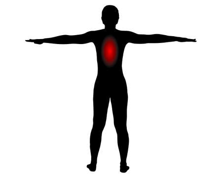Back view of woman with symbol for pain in the backのイラスト素材