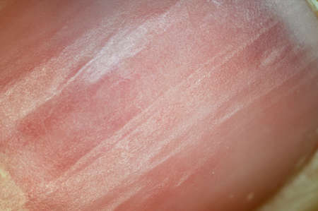 Macro detail of nail scratches.