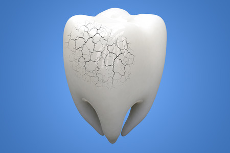 Illness Tooth on blue background. 3d illustration.