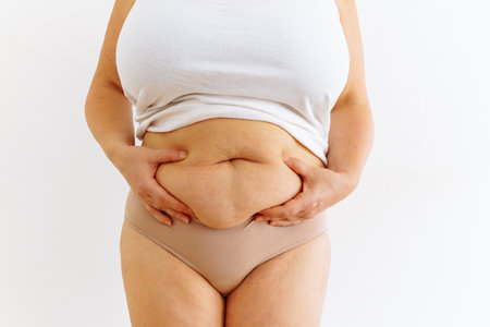 unrecognizable fat woman of large size, middle-aged in underwear touches and squeezes large fat hanging belly. self-massage for flabby cellulite skin. body care, body positiveの写真素材