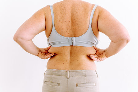 Middle-aged woman, plump, flabby skin with age spotsの写真素材