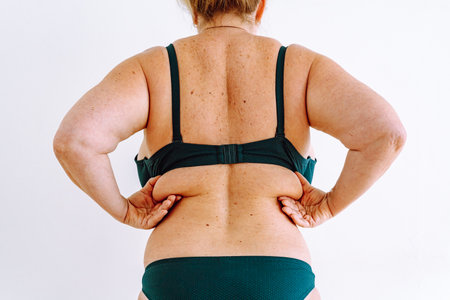 Middle-aged woman, plump, flabby skin with age spotsの写真素材