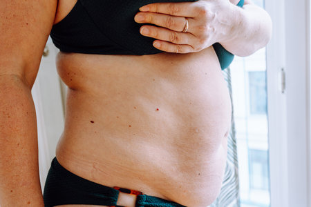 Middle-aged woman, plump, flabby skin with age spotsの写真素材