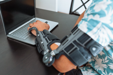 Man with adjustable articulated elbow orthosis typing on laptop keyboardの写真素材