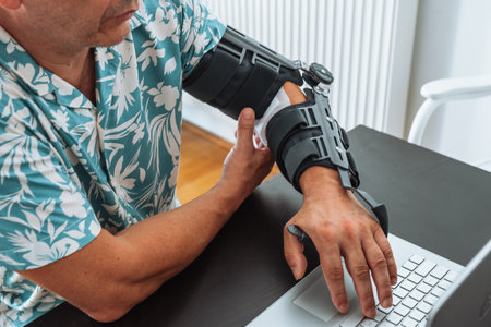 Man with adjustable articulated elbow orthosis typing on laptop keyboardの写真素材