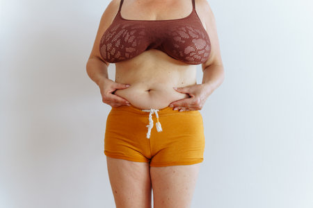 unrecognizable woman showing belly with saggy skinの写真素材