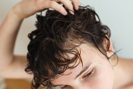 early baldness in women