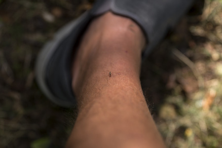 A mosquito on a leg getting the bloodの写真素材