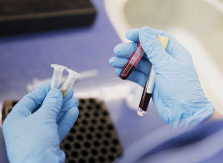 close up doctor holding tube with blood. Resolution and high quality beautiful photoの写真素材