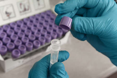 Hand of scientist in blue gloves with blood test tube. Medical laboratory testing, analysis and...