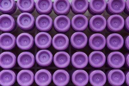 Blood test sample tubes pattern. Medical laboratory testing, analysis and research. Chemistry, science, biology experiment technology, pharmacy. Creative minimalistic concept of medical researchの写真素材