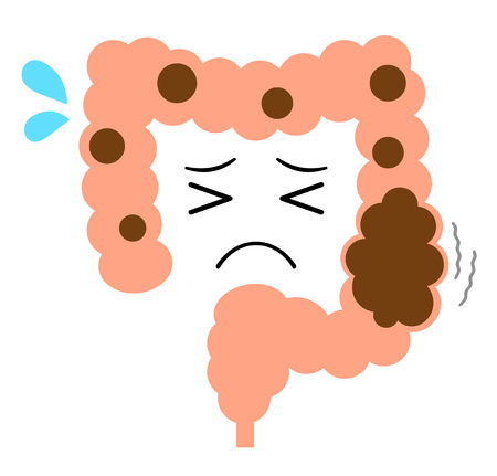 The large intestines which suffer from constipation.の写真素材