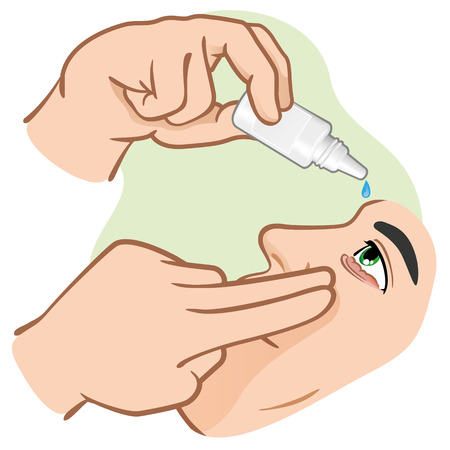 Eye drops Medicament illustration to ping us angry eyes. ideal for training materials, catalogs and institutionalのイラスト素材