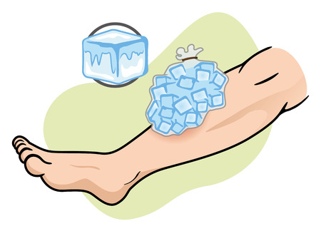 Illustration representing First Aid with ice compress on the injured legのイラスト素材