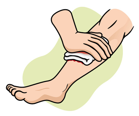 Illustration of a leg receiving first aid compression leg injury. Ideal for medical supplies educational and institutionalのイラスト素材