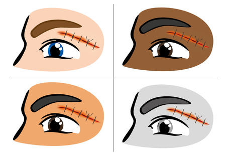 Illustration of a receiving first aid, injury or cut and sutured faceのイラスト素材